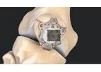 Arthrex - Model II – 3 mm - Patella Suture Plate System