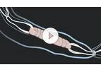 GraftLink - ACL Reconstruction Backup Fixation System