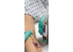 Kurin Lock - SIMPLE Solution for Improved Blood Culture Collection