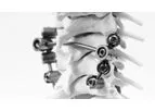 K.M. BABY - Adult Cervical Arthrodesis & Paediatric Spinal Deformities