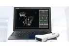 Pathway - Ultrasound Imaging System for Lumbopelvic Rehabilitation