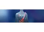 Biostage - Cellspan Esophageal Implants