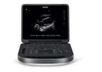 Sonosite Edge - Model II - Ultrasound Machine