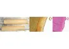 TRUE - Vascular Graft