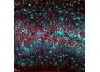 Neurona - Chronic Disorders of the Nervous System