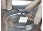AmnioGraft - Biologic Ocular Transplantation Graft