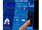 Intellivent - Model ASV - Intelligent Ventilation Mode