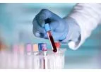 OPKO 4Kscore - Test Kit