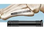 i2b 5MS - Jones Fracture Screws