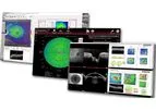 Heidelberg - Version HEYEX 2 - Eye Explorer Software Solution