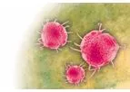 LIAISON - Measles IgG