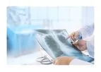 Lung Therapeutics - Model LTI-03 - Revolutionary Compound for the Treatment of Idiopathic Pulmonary Fibrosis (IPF)