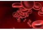 Majelco Medical - Surgical Blood Loss Measurement