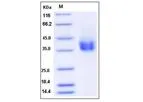 Sino - Model CD89 - 80014-R08H - Rat Recombinant Protein (His Tag)