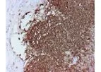Novodiax - Model CD20 Ab - Rapid IHC Panel