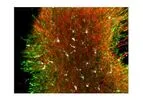 Stem Pharm - Advanced Neural Organoids Models
