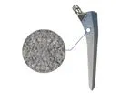Quadra - Model P - Hip Replacement Joint