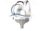 Medacta - Model GMK- Sphere - Total Knee System
