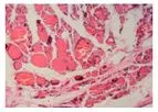 in.vent - Tissues