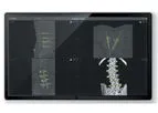 Fiagon - Version VirtuSuite - SPINE Navigation Software