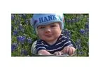 DOC Band - Plagiocephaly, Brachycephaly and Scaphocephaly Device