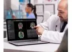 QyScore - Groundbreaking Neuroimaging Analysis Platform Software