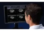 Ultrasound Enhancement System