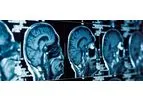 Diagnostic Imaging
