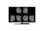 QView Medical - Model QVCAD - CAD System for 3D Automated Breast Ultrasound
