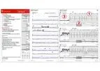 Bardy - Carnation Ambulatory Monitor (CAM) Report Software