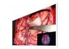 CuratOR - Model EX5542 - 55-Inch Widescreen Surgical Monitor