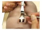 3di - Rhinoplasty Soft Tissue Model