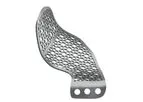 Meticuly - Patient-Specific Oculoplastic Mesh