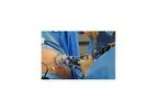 Sejong - Single Port Laparoscopic Surgery