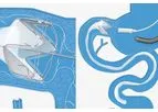 EndoBarrier - Endoscopically Delivered Medical Device