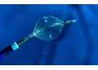 PiCSO - Pressure-controlled intermittent Coronary Sinus Occlusion