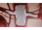 Red Vascular - Branch Graft