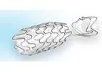 Allium - Round Posterior Stent (RPS)