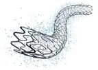 Medinol - Model EluNIR - Ridaforolimus Eluting Coronary Stent System