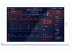 Biobeat - Early Warning Score (EWS) System