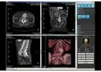 IMAGE - Version iQ-3D - Post-Processing Workstation Software