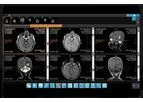 IMAGE - Version iQ-4VIEW - Web-Based Diagnostic Zero-Footprint Viewer Software