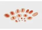 Model WK100 - Adult Emergency Wound Kit