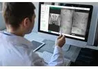 Intellijoint VIEW - Web-Based Surgical Planning Solution
