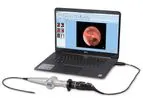 Optim ENTity - Mobile FEES System for Voice & Swallowing Diagnostics