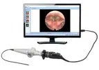 Optim VidCap - USB Camera for ENT Endoscopy