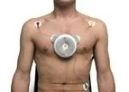 D-Heart - Smallest and Easiest 12 Lead ECG Device