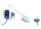 Model WatchPAT 300 - Home Sleep Apnea Test (HSAT)