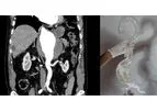 Axial3d - Solution for Interventionalists