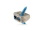 Irix-C - Cervical Integrated Fusion System